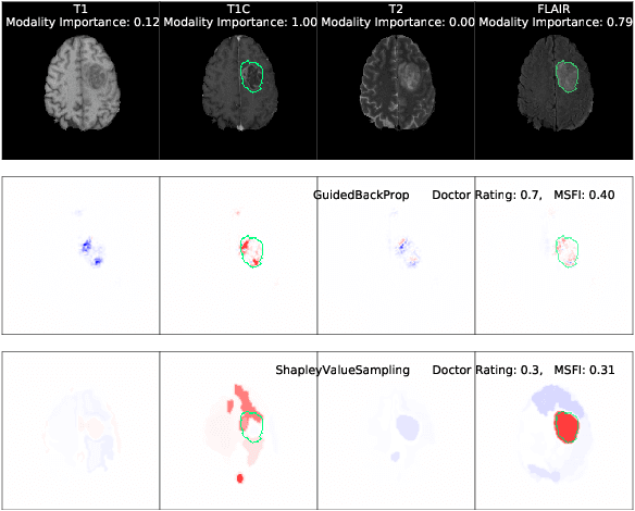 Figure 1 for One Map Does Not Fit All: Evaluating Saliency Map Explanation on Multi-Modal Medical Images