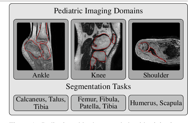 Figure 1 for Generalizable multi-task, multi-domain deep segmentation of sparse pediatric imaging datasets via multi-scale contrastive regularization and multi-joint anatomical priors