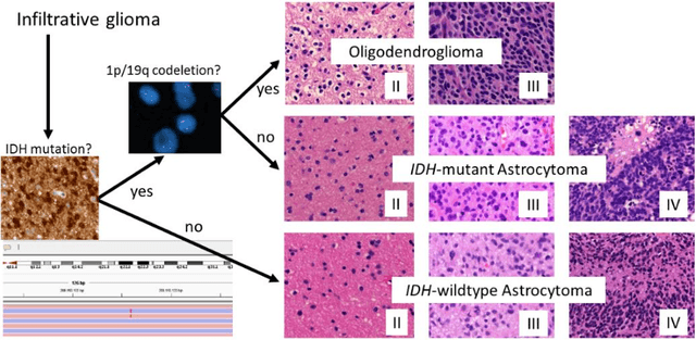 Figure 1 for Prediction of overall survival and molecular markers in gliomas via analysis of digital pathology images using deep learning