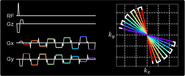 Figure 1 for Free-Breathing Water, Fat, $R_2^{\star}$ and $B_0$ Field Mapping of the Liver Using Multi-Echo Radial FLASH and Regularized Model-based Reconstruction (MERLOT)