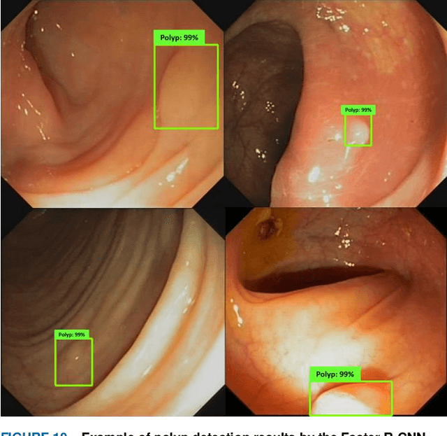 Figure 2 for Abnormal Colon Polyp Image Synthesis Using Conditional Adversarial Networks for Improved Detection Performance