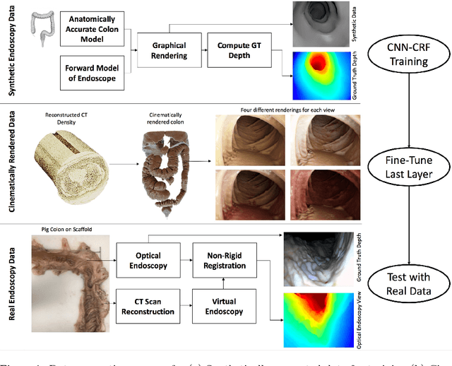 Figure 1 for Deep Learning with Cinematic Rendering: Fine-Tuning Deep Neural Networks Using Photorealistic Medical Images