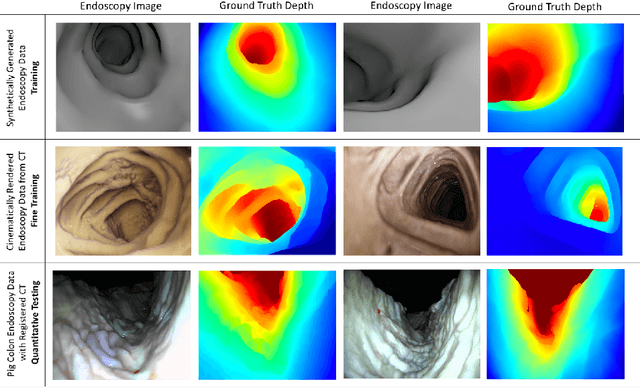 Figure 3 for Deep Learning with Cinematic Rendering: Fine-Tuning Deep Neural Networks Using Photorealistic Medical Images