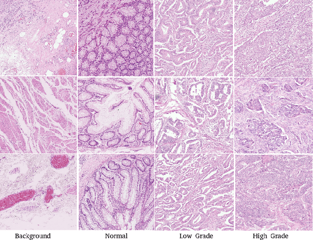 Figure 3 for Deep Multi-Resolution Dictionary Learning for Histopathology Image Analysis
