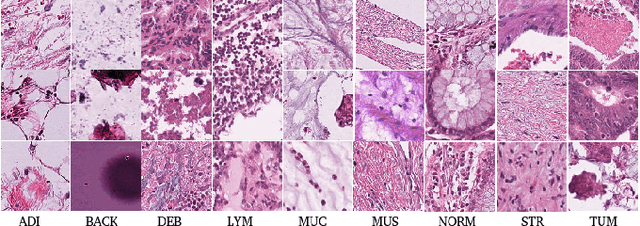 Figure 4 for Deep Multi-Resolution Dictionary Learning for Histopathology Image Analysis