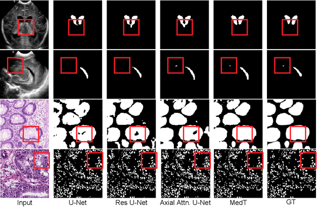 Figure 4 for Medical Transformer: Gated Axial-Attention for Medical Image Segmentation