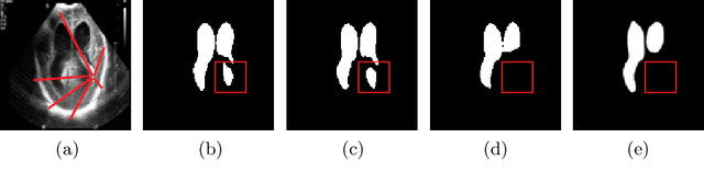 Figure 1 for Medical Transformer: Gated Axial-Attention for Medical Image Segmentation