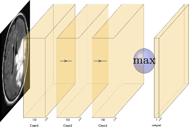 Figure 2 for Unsupervised deep clustering and reinforcement learning can accurately segment MRI brain tumors with very small training sets