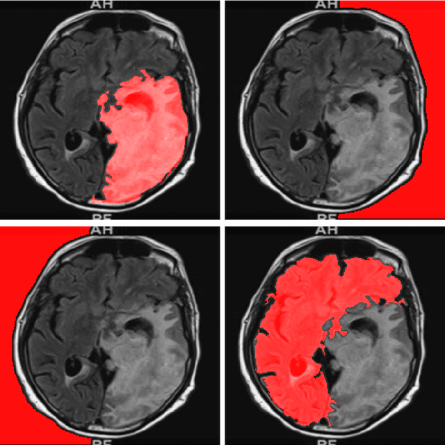 Figure 4 for Unsupervised deep clustering and reinforcement learning can accurately segment MRI brain tumors with very small training sets