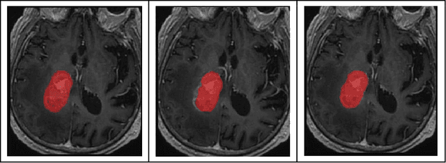 Figure 2 for Deep Learning Based Segmentation of Various Brain Lesions for Radiosurgery