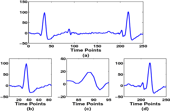 Figure 1 for Compressed Sensing for Energy-Efficient Wireless Telemonitoring of Noninvasive Fetal ECG via Block Sparse Bayesian Learning