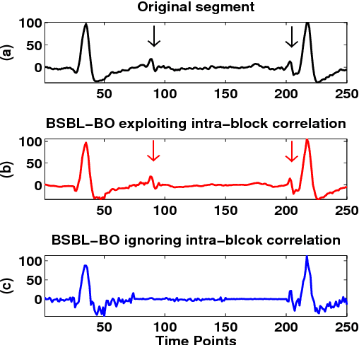 Figure 2 for Compressed Sensing for Energy-Efficient Wireless Telemonitoring of Noninvasive Fetal ECG via Block Sparse Bayesian Learning