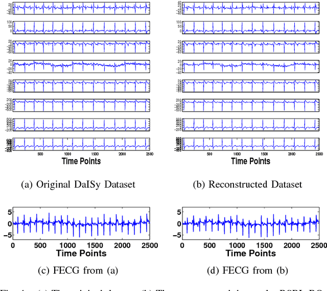 Figure 4 for Compressed Sensing for Energy-Efficient Wireless Telemonitoring of Noninvasive Fetal ECG via Block Sparse Bayesian Learning