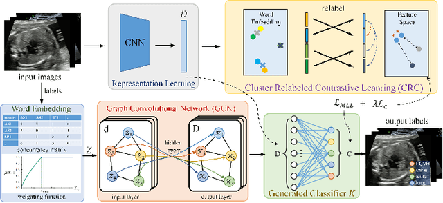 Figure 3 for Statistical Dependency Guided Contrastive Learning for Multiple Labeling in Prenatal Ultrasound