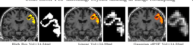 Figure 3 for Scale factor point spread function matching: Beyond aliasing in image resampling