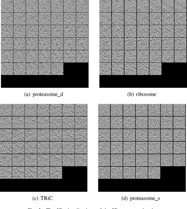 Figure 3 for Deep Learning-Based Strategy for Macromolecules Classification with Imbalanced Data from Cellular Electron Cryotomography
