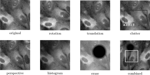 Figure 2 for Image Forensics: Detecting duplication of scientific images with manipulation-invariant image similarity