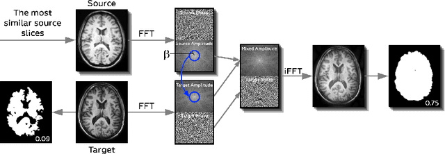 Figure 1 for Feather-Light Fourier Domain Adaptation in Magnetic Resonance Imaging