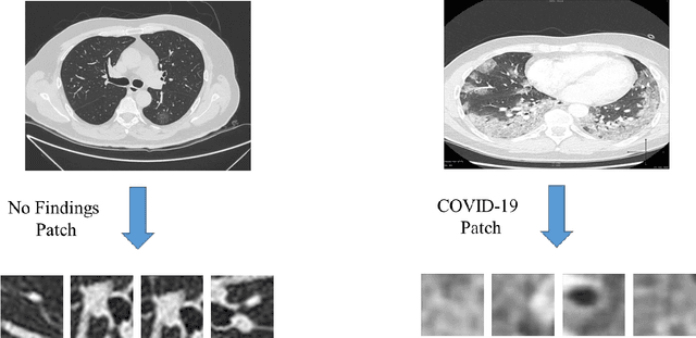 Figure 2 for Coronavirus (COVID-19) Classification using Deep Features Fusion and Ranking Technique