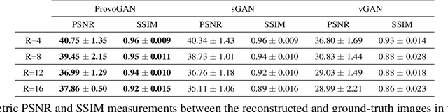 Figure 4 for Progressively Volumetrized Deep Generative Models for Data-Efficient Contextual Learning of MR Image Recovery