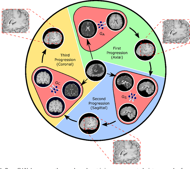 Figure 1 for Progressively Volumetrized Deep Generative Models for Data-Efficient Contextual Learning of MR Image Recovery