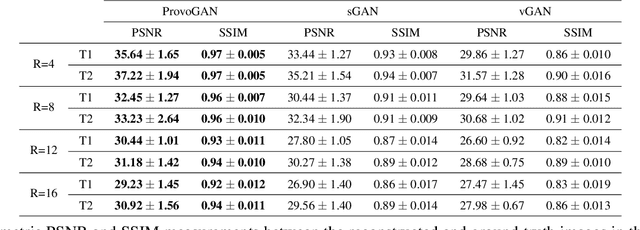 Figure 2 for Progressively Volumetrized Deep Generative Models for Data-Efficient Contextual Learning of MR Image Recovery