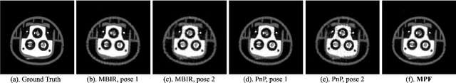 Figure 2 for Multi-Pose Fusion for Sparse-View CT Reconstruction Using Consensus Equilibrium