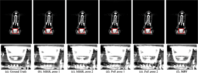 Figure 3 for Multi-Pose Fusion for Sparse-View CT Reconstruction Using Consensus Equilibrium