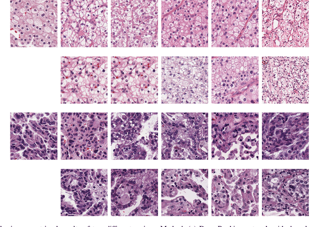 Figure 2 for A Personalized Diagnostic Generation Framework Based on Multi-source Heterogeneous Data