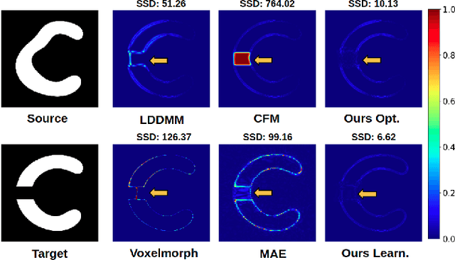 Figure 3 for A deep residual learning implementation of Metamorphosis