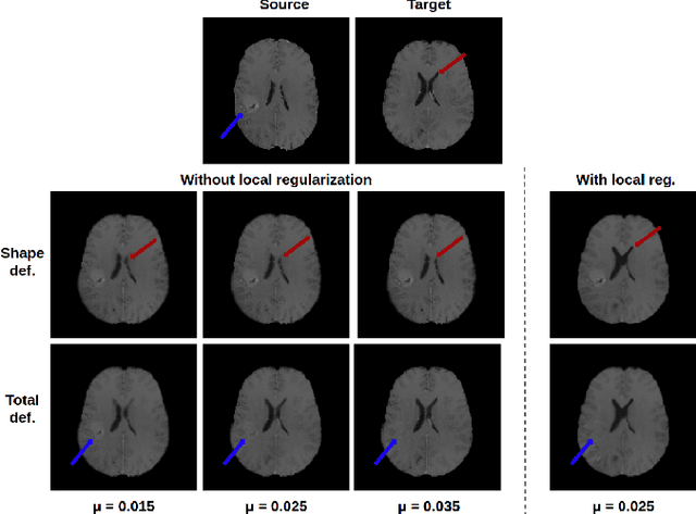 Figure 4 for A deep residual learning implementation of Metamorphosis