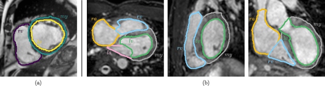 Figure 1 for A persistent homology-based topological loss for CNN-based multi-class segmentation of CMR