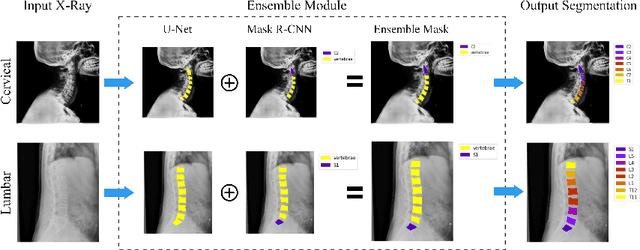 Figure 1 for VertXNet: Automatic Segmentation and Identification of Lumbar and Cervical Vertebrae from Spinal X-ray Images