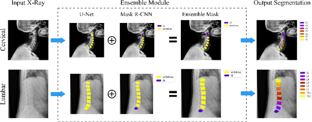 Figure 1 for VertXNet: Automatic Segmentation and Identification of Lumbar and Cervical Vertebrae from Spinal X-ray Images