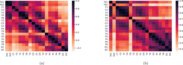 Figure 2 for EEG functional connectivity and deep learning for automatic diagnosis of brain disorders: Alzheimer's disease and schizophrenia