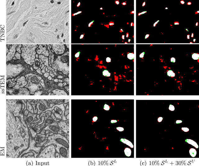 Figure 1 for Edge-Based Self-Supervision for Semi-Supervised Few-Shot Microscopy Image Cell Segmentation