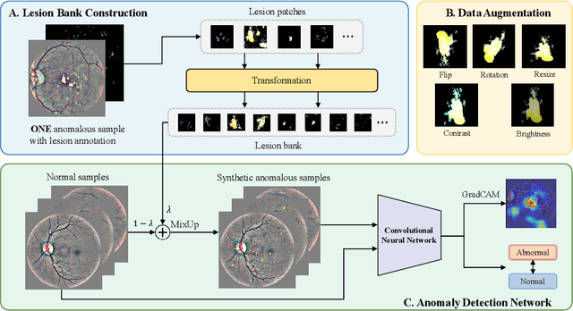 Figure 1 for LesionPaste: One-Shot Anomaly Detection for Medical Images