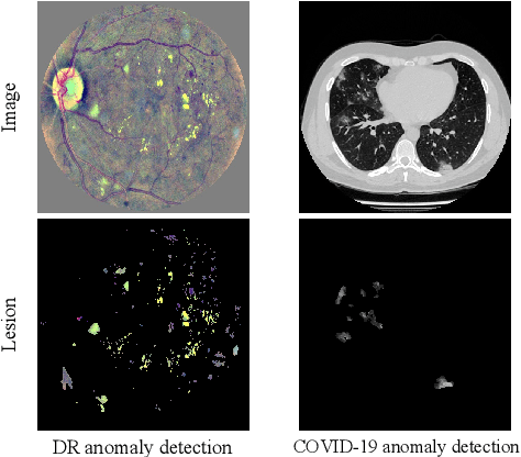 Figure 3 for LesionPaste: One-Shot Anomaly Detection for Medical Images