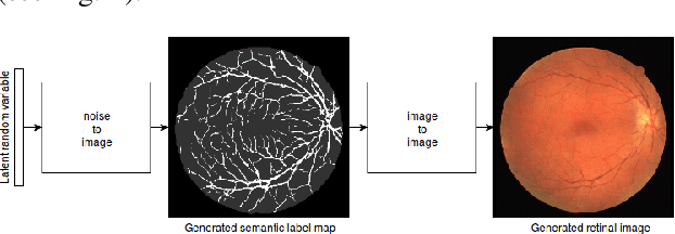 Figure 1 for A Two Stage GAN for High Resolution Retinal Image Generation and Segmentation
