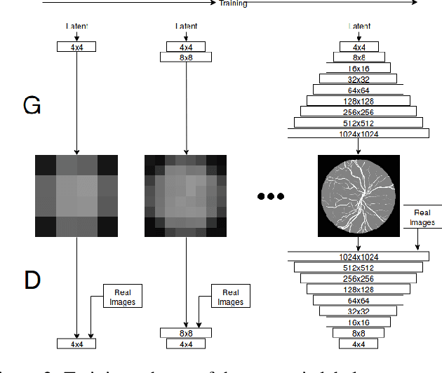 Figure 3 for A Two Stage GAN for High Resolution Retinal Image Generation and Segmentation