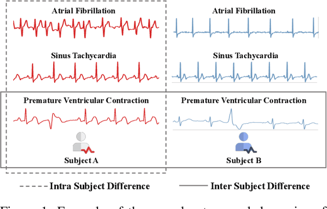 Figure 1 for Intra-Inter Subject Self-supervised Learning for Multivariate Cardiac Signals