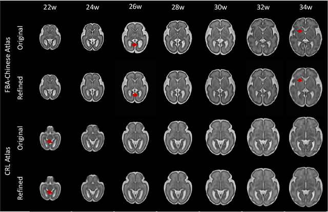 Figure 4 for Continuous longitudinal fetus brain atlas construction via implicit neural representation