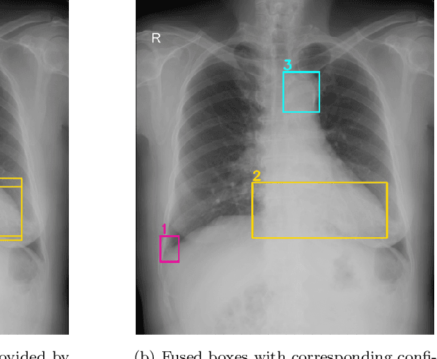 Figure 3 for Learning from Multiple Expert Annotators for Enhancing Anomaly Detection in Medical Image Analysis