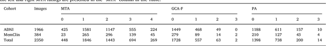 Figure 3 for AVRA: Automatic Visual Ratings of Atrophy from MRI images using Recurrent Convolutional Neural Networks