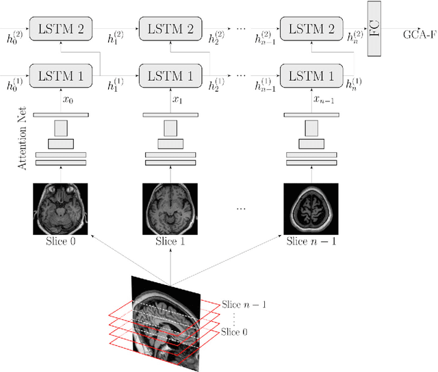 Figure 4 for AVRA: Automatic Visual Ratings of Atrophy from MRI images using Recurrent Convolutional Neural Networks