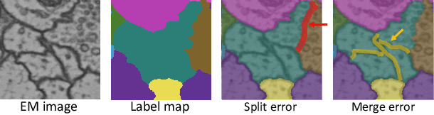 Figure 1 for RLCorrector: Reinforced Proofreading for Connectomics Image Segmentation