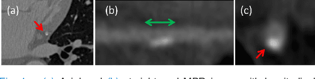 Figure 1 for A Recurrent CNN for Automatic Detection and Classification of Coronary Artery Plaque and Stenosis in Coronary CT Angiography