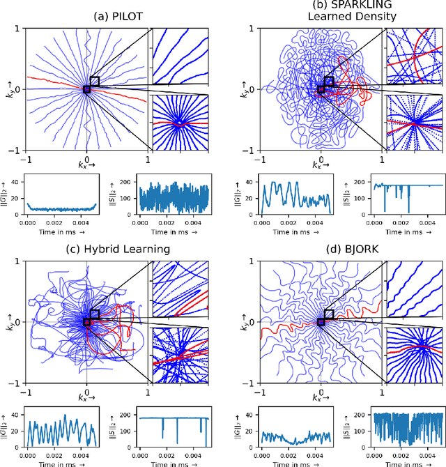 Figure 2 for Benchmarking learned non-Cartesian k-space trajectories and reconstruction networks