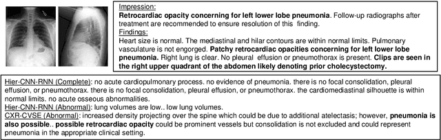 Figure 1 for Learning Visual-Semantic Embeddings for Reporting Abnormal Findings on Chest X-rays