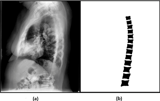 Figure 2 for Automated Segmentation of Vertebrae on Lateral Chest Radiography Using Deep Learning